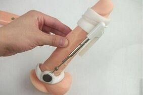 Verwenden eines Extenders zur Vergrößerung des Penis